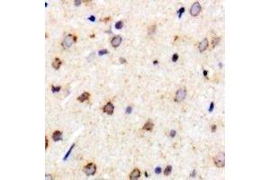 Immunohistochemical analysis of Metaxin-1 staining in rat brain formalin fixed paraffin embedded tissue section. (Metaxin 1 anticorps)