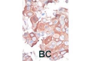 Immunohistochemistry (IHC) image for anti-Mitogen-Activated Protein Kinase Kinase Kinase 1 (MAP3K1) antibody (ABIN3003567) (MAP3K1 anticorps)