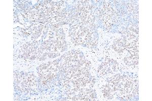 Immunohistochemistry (IHC) image for anti-hSET1 (AA 1200-1250) antibody (ABIN7454027)