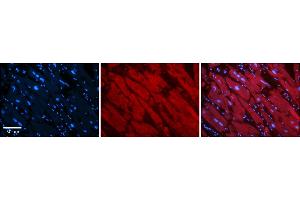 Rabbit Anti-ASPH Antibody    Formalin Fixed Paraffin Embedded Tissue: Human Adult heart  Observed Staining: Cytoplasmic Primary Antibody Concentration: 1:600 Secondary Antibody: Donkey anti-Rabbit-Cy2/3 Secondary Antibody Concentration: 1:200 Magnification: 20X Exposure Time: 0.