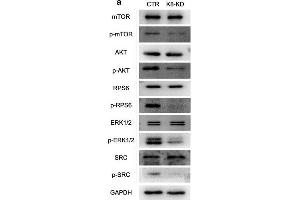 Human KBTBD8 regulated the activity of multiple cell cycle kinases in EOC cells. (MTOR anticorps  (pSer2448))