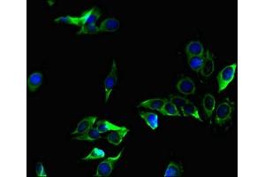 Immunofluorescent analysis of Hela cells using ABIN7176028 at dilution of 1:100 and Alexa Fluor 488-congugated AffiniPure Goat Anti-Rabbit IgG(H+L)
