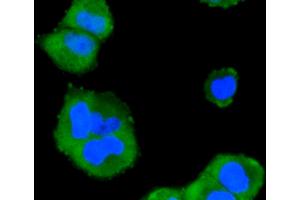 Immunofluorescence analysis of HeLa cells using MAPK14 antibody (ABIN5997045). (MAPK14 anticorps)