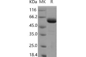 Western Blotting (WB) image for F11 Receptor (F11R) protein (Fc Tag) (ABIN7321178) (F11R Protein (Fc Tag))