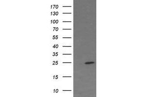 Image no. 3 for anti-Fetal and Adult Testis Expressed 1 (FATE1) antibody (ABIN1498225) (FATE1 anticorps)