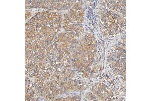 IHC analysis of SLC20A1 using anti-SLC20A1 antibody (ABIN7602463).