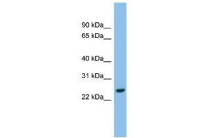 WB Suggested Anti-AK2 Antibody Titration: 0. (Adenylate Kinase 2 anticorps  (Middle Region))