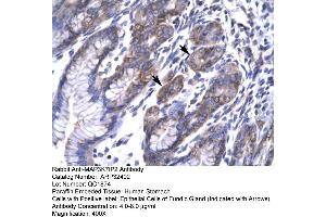 Human Stomach (TAB2 anticorps  (N-Term))
