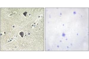 Immunohistochemistry analysis of paraffin-embedded human brain tissue, using FGFR3 Antibody. (FGFR3 anticorps  (AA 131-180))