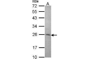 WB Image Sample (30 ug of whole cell lysate) A: Hep G2 , 12% SDS PAGE antibody diluted at 1:1000 (STXBP6 anticorps  (N-Term))