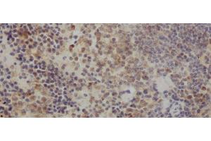 Immunohistochemistry of paraffin-embedded Rat spleen using IL10 Polyclonal Antibody at dilution of 1:50 (IL-10 anticorps)