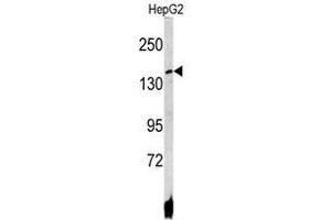 Image no. 1 for anti-ATPase, Cu++ Transporting, beta Polypeptide (ATP7B) (C-Term) antibody (ABIN452773) (ATP7B anticorps  (C-Term))