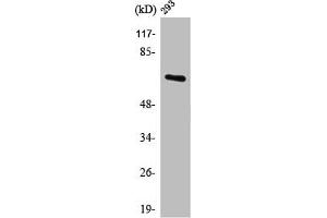 Western Blot analysis of 293 cells using POTE14/22 Polyclonal Antibody (POTEG/POTEH/POTEM (C-Term) anticorps)