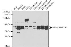 Western blot analysis of extracts of various cell lines, using NSD3/NSD3/WHSC1L1 antibody (ABIN6130794, ABIN6150215, ABIN6150216 and ABIN6221225) at 1:1000 dilution. (WHSC1L1 anticorps  (AA 1-270))