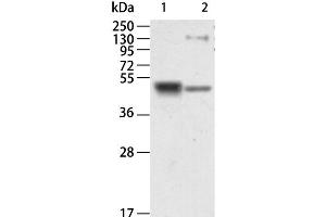 Western Blot analysis of Human kidney and Mouse brain tissue using RAGE Polyclonal Antibody at dilution of 1:750 (RAGE anticorps)