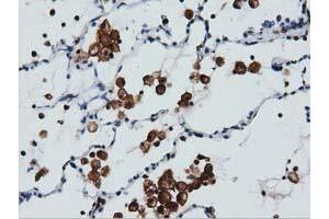 Immunohistochemical staining of paraffin-embedded Human colon tissue using anti-ARHGAP25 mouse monoclonal antibody. (ARHGAP25 anticorps)