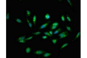 Immunofluorescent analysis of Hela cells using ABIN7146404 at dilution of 1:100 and Alexa Fluor 488-congugated AffiniPure Goat Anti-Rabbit IgG(H+L)