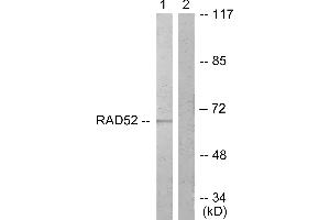 Immunohistochemistry analysis of paraffin-embedded human braIin tissue using DRP-2 (Ab-514) antibody. (DRP2 anticorps  (Thr514))