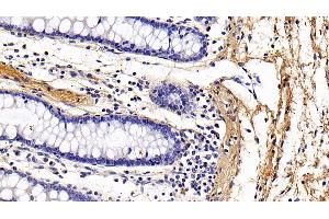 Detection of COL1a1 in Human Colon Tissue using Monoclonal Antibody to Collagen Type I Alpha 1 (COL1a1)