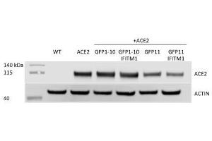 ACE2 expression assessed by western blot in U2OS-ACE2 GFP-split cells expressing or not IFITM1.
