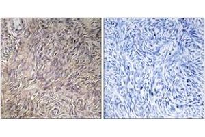 Immunohistochemistry analysis of paraffin-embedded human ovary tissue, using FGF22 Antibody.