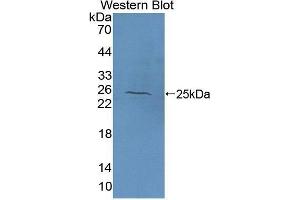 Western Blotting (WB) image for anti-N-Acetylgalactosaminidase, alpha (NAGA) (AA 18-217) antibody (ABIN1176638) (NAGA anticorps  (AA 18-217))