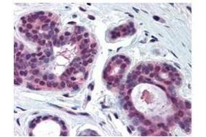 Anti-CDK2 antibody was diluted 1:500 to detect CDK2 in human skin tissue.