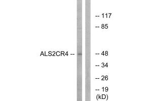 Western Blotting (WB) image for anti-Transmembrane Protein 237 (TMEM237) (Internal Region) antibody (ABIN1850756) (TMEM237 anticorps  (Internal Region))
