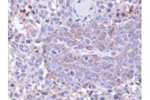 IHC-P Image Immunohistochemical analysis of paraffin-embedded SAS xenograft, using PPP1CC, antibody at 1:100 dilution.