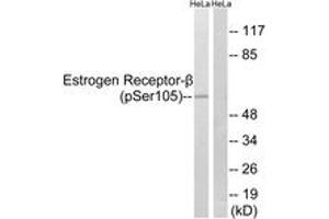 Western blot analysis of extracts from HeLa cells, using Estrogen Receptor-beta (Phospho-Ser105) Antibody. (ESR2 anticorps  (pSer105))