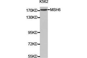 Western Blotting (WB) image for anti-MutS Homolog 6 (E. Coli) (MSH6) antibody (ABIN1873754) (MSH6 anticorps)