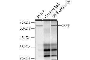 Immunoprecipitation analysis of 300 μg extracts of HepG2 cells using 3 μg IRF6 antibody (ABIN1680921, ABIN3017588, ABIN3017589 and ABIN7101507).