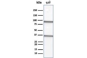 anti-Membrane-Spanning 4-Domains, Subfamily A, Member 1 (MS4A1) antibody