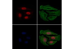 ABIN6256332 and ABIN6267233 staining Hela cells(4h of LPS treatment) by IF/ICC.