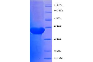 Ribosomal Protein L29 (RPL29) (AA 1-63), (full length) protein (GST tag)