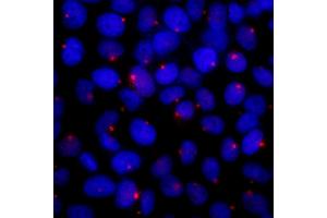 anti-Centrosomal Protein of 131 kDa (CEP131) (AA 1-50) antibody