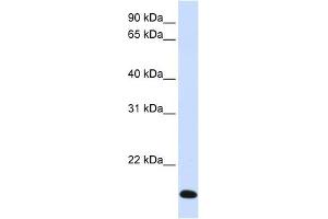 RNF185 antibody used at 1 ug/ml to detect target protein. (RNF185 anticorps  (Middle Region))