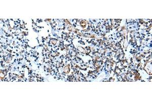Immunohistochemistry of paraffin-embedded Human tonsil tissue using USP37 Polyclonal Antibody at dilution of 1:45(x200) (USP37 anticorps)