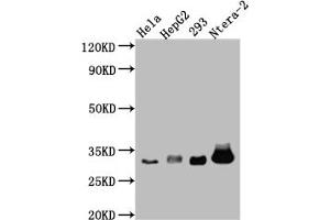 Western Blot Positive WB detected in: Hela whole cell lysate, HepG2 whole cell lysate, HEK293 whole cell lysate, Ntera-2 whole cell lysate All lanes: pro Caspase 3 antibody at 1:1000 Secondary Goat polyclonal to rabbit IgG at 1/50000 dilution Predicted band size: 32 kDa Observed band size: 32 kDa (Recombinant Caspase 3 anticorps)