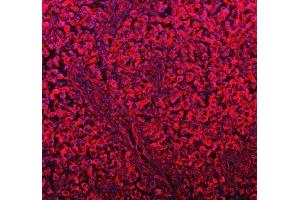 IF analysis of DYNLT1 using anti-DYNLT1 antibody (ABIN5693148).