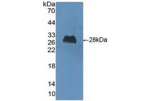Detection of Recombinant ChAT, Human using Polyclonal Antibody to Choline Acetyltransferase (ChAT) (Choline Acetyltransferase anticorps  (AA 517-732))