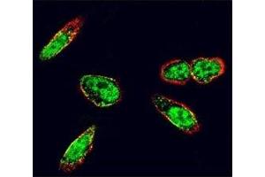 Confocal immunofluorescent analysis of c-Src antibody with A375 cells followed by Alexa Fluor 488-conjugated goat anti-rabbit lgG (green).