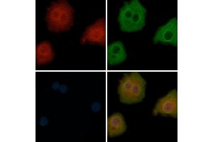 ABIN6265187 and ABIN6272863 staining Hela cells by IF/ICC. (SMCR7L anticorps  (Internal Region))