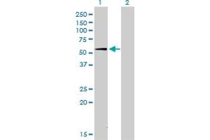 Western Blot analysis of SUOX expression in transfected 293T cell line by SUOX monoclonal antibody (M01), clone 1H1.