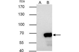 IP Image Nucleoporin p62 antibody immunoprecipitates NUP62 protein in IP experiments. (NUP62 anticorps)