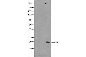 Western blot analysis on LOVO cell lysate using JM4 Antibody. (PRAF2 anticorps  (C-Term))