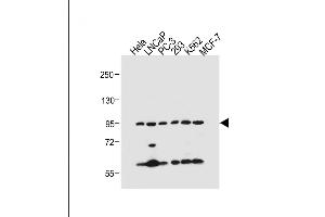 All lanes : Anti-PKN beta Antibody (C-term) at 1:500 dilution Lane 1: Hela whole cell lysate Lane 2: LNCaP whole cell lysate Lane 3: PC-3 whole cell lysate Lane 4: 293 whole cell lysate Lane 5: K562 whole cell lysate Lane 6: MCF-7 whole cell lysate Lysates/proteins at 20 μg per lane. (PKN beta anticorps  (C-Term))