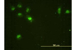 Immunofluorescence of monoclonal antibody to CDC2L5 on HeLa cell. (CDK13 anticorps  (AA 1-324))