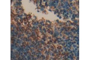 Used in DAB staining on fromalin fixed paraffin- embedded Kidney tissue (LAT2 anticorps  (AA 29-193))