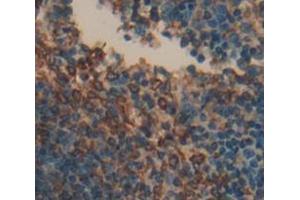 Used in DAB staining on fromalin fixed paraffin- embedded Kidney tissue